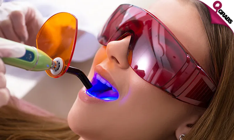 Tooth Filling, X-ray + Consultation!